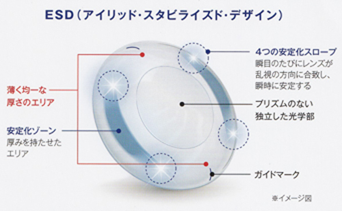 ESD　乱視用　コンタクトレンズ